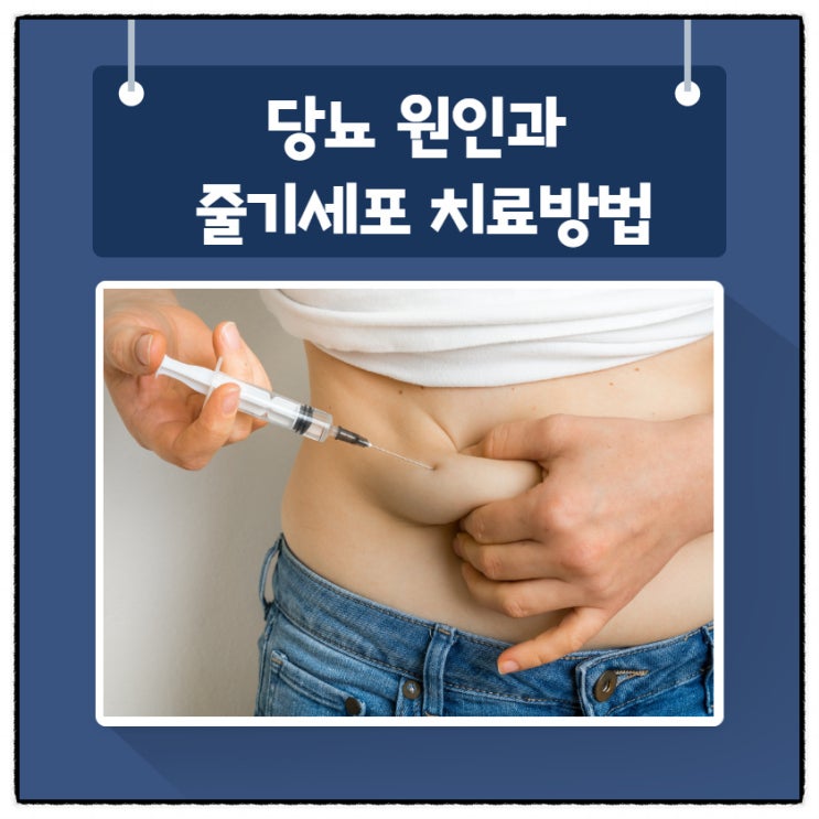  당뇨 원인과 증상! 줄기세포치료방법