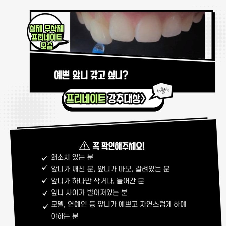  치과의사는 가족에게는 라미네이트 안한다고요? 저희 치과의사선생님은 본인 이에 직접 "프리네이트"하셨어요!