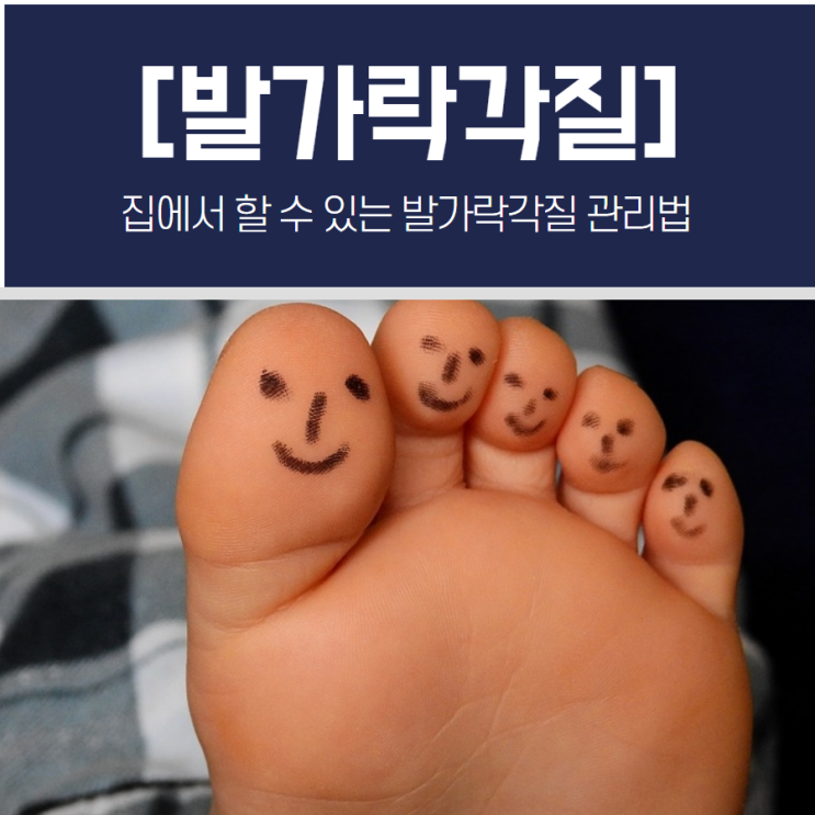  집에서 할 수 있는 발가락각질 관리법