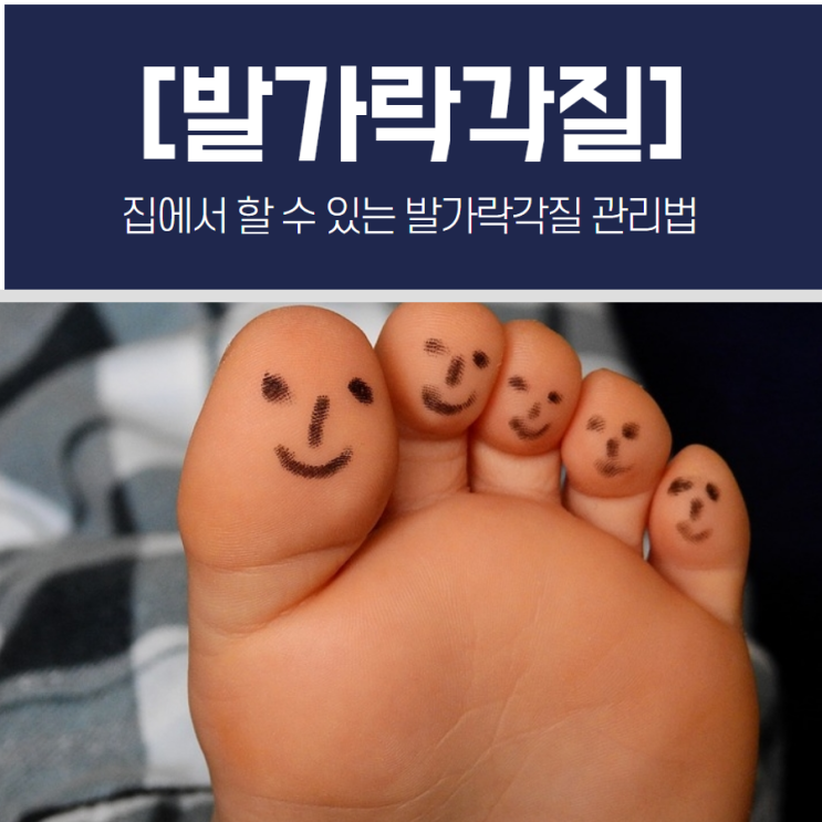 집에서 할 수 있는 발가락각질 관리법