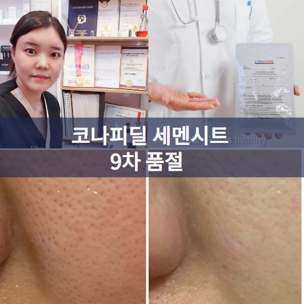  [신중동피부관리] 모공실종+탱탱탄력 세멘시트 9차 완판.