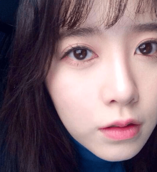  남자 여자 여드름 쉽게 없애고 피부 좋아지는 법 (화농성 좁쌀 둘다)