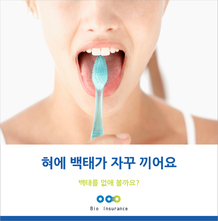  혀에 백태가 끼는 원인