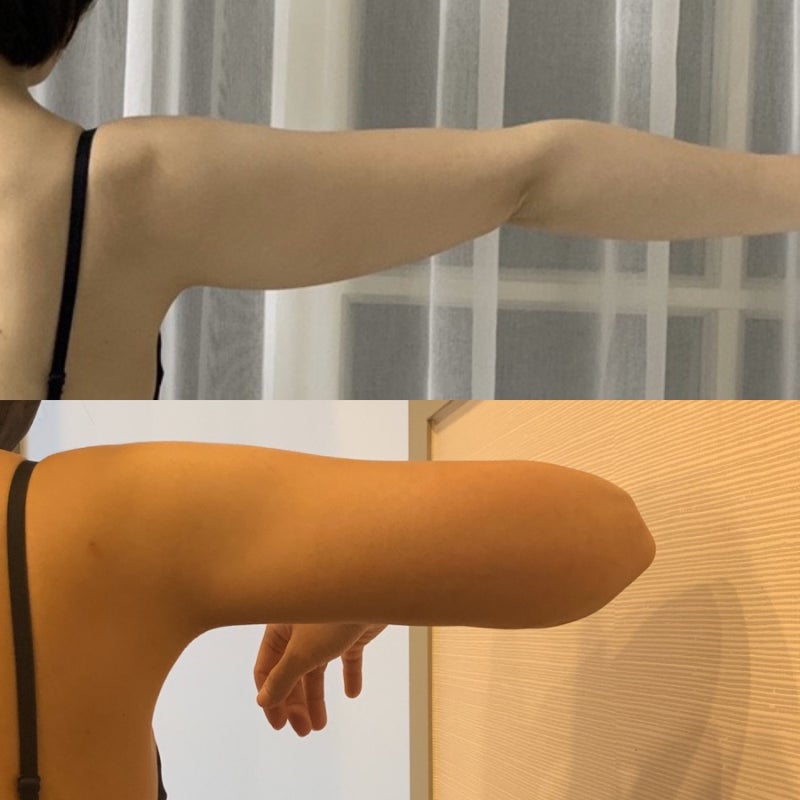 팔무한람스 한달 경과 1개월 후기 : 네이버 블로그