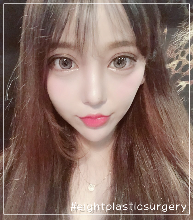  눈밑트임으로 또렷하고 선명한 눈을 가져보세요