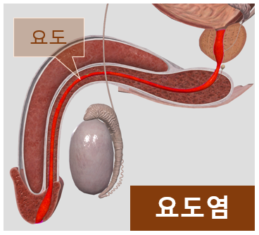 남자 요도염 증상, 검사 : 네이버 블로그 남자 요도염 증상, 검사 : 네이버 블로그