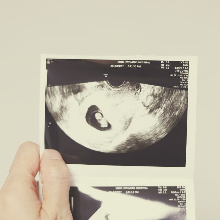  임신초기증상 나타나는시기?1~6주차별로 이렇게!