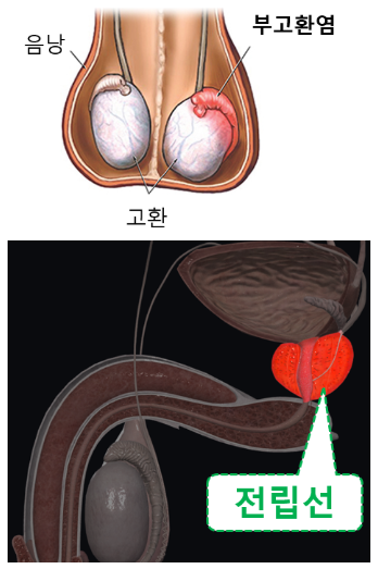 남자 유레아플라즈마균 증상, 원인, 검사 (유레아플라스마, Ureaplasma) : 네이버 블로그