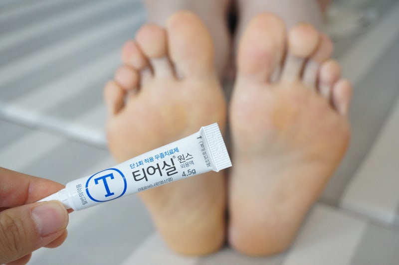 무좀 증상 예방법은 이제 지켜야 해요. 11