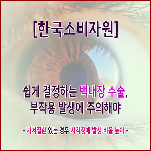  [한국소비자원] 쉽게 결정하는 백내장 수술, 부작용 발생에 주의해야