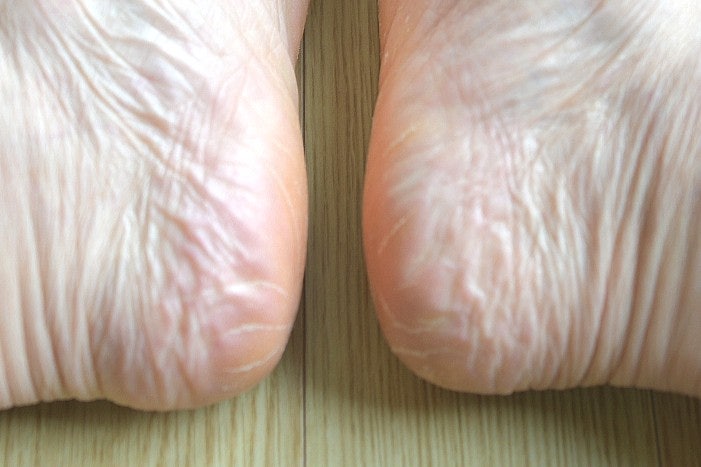 발각질관리·풋제스 각질제거기를 선택한 이유 3