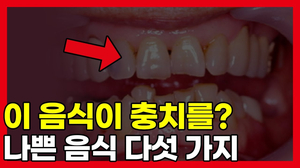 우리가 자꾸 충치가 생기는 이유가 '이 음식' 때문? 양치질을 해도 충치가 생기나요?