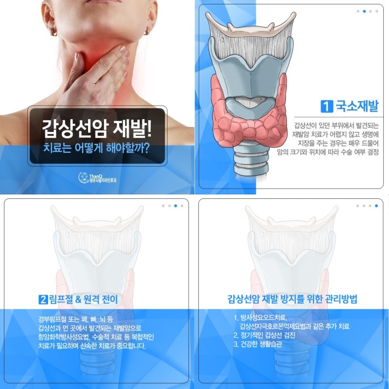 갑상선암 재발 이렇게 막아야 한다