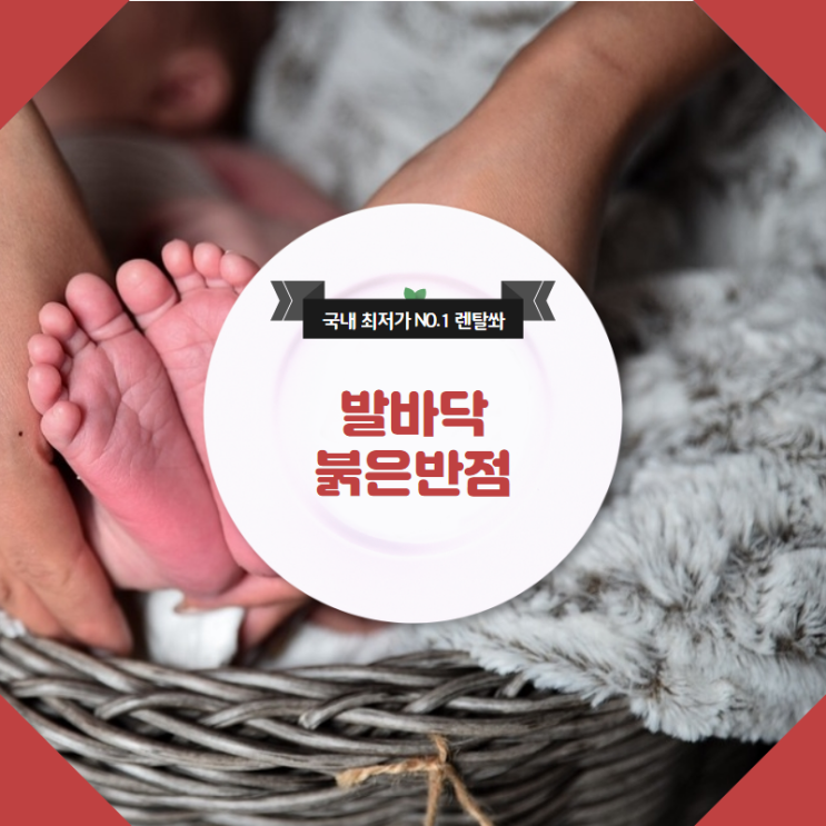  발바닥붉은반점 왜 생기는 것일까요?