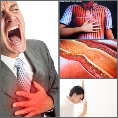 가슴이 답답한 증상 코르토닌 포뮬러로 7
