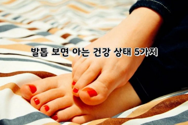 발톱 보면 아는 건강 상태