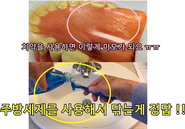  틀니닦는법,틀니사용시주의사항-익숙해지면쉬워요^^