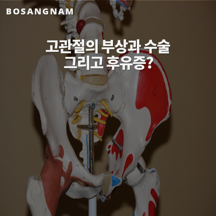  보험 마켓 17. 고관절(Hip joint)의 부상과 후유증, 수술에 대하여