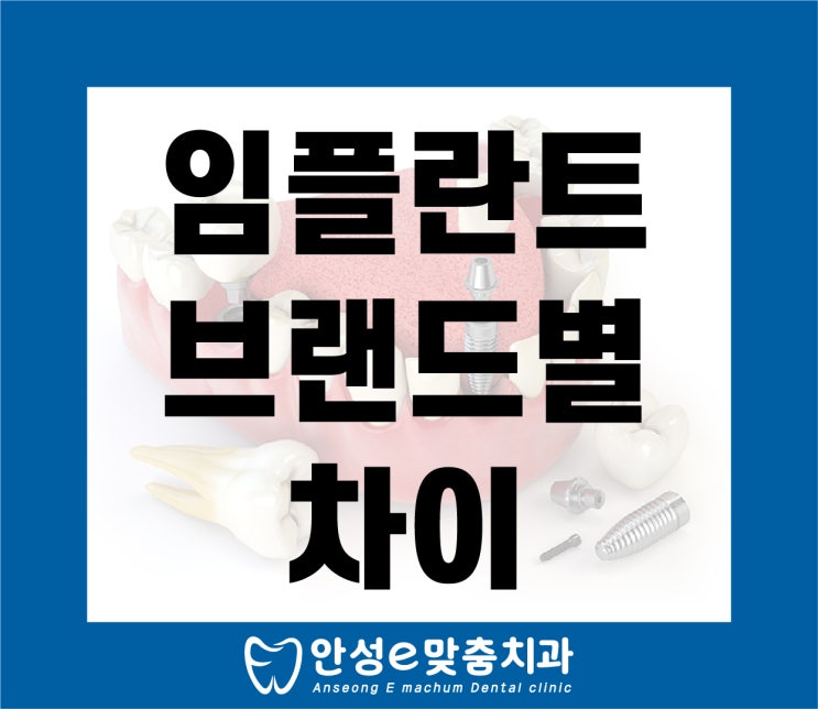  안성터미널 인근, e맞춤치과가 알려드리는 임플란트 브랜드 차이