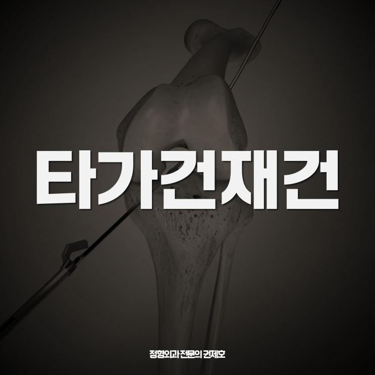  타가건 allograft을 이용한 전방십자인대 재건