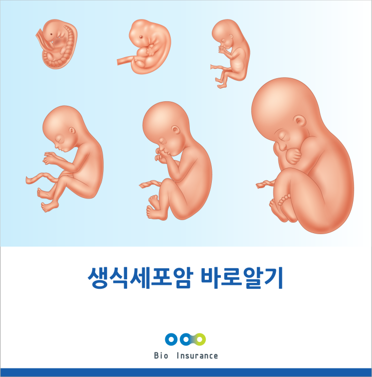  생식세포암 바로 알기