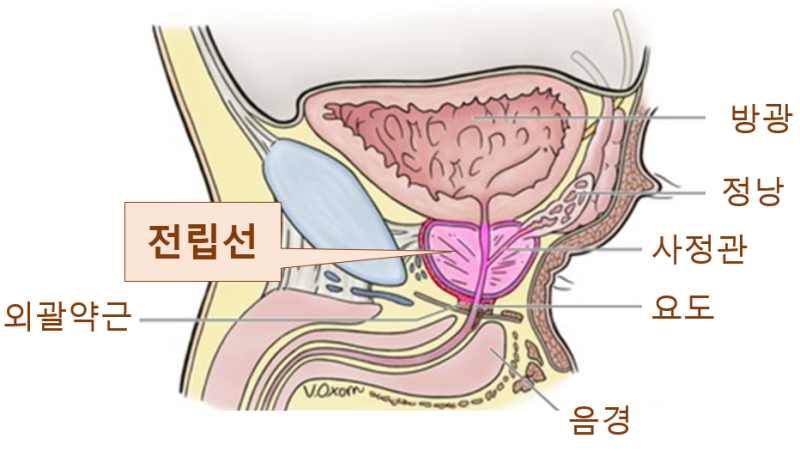역삼역비뇨기과 전립선비대증 치료를 위해서는
