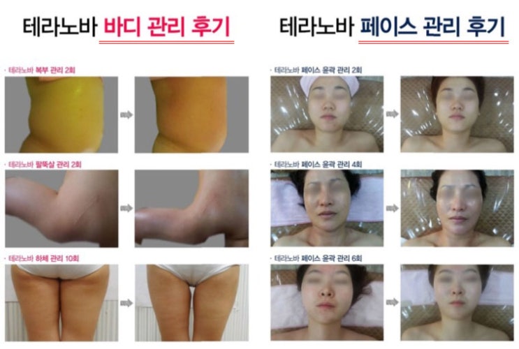  #다이어트 #전신 #체형관리 의 끝판왕^^