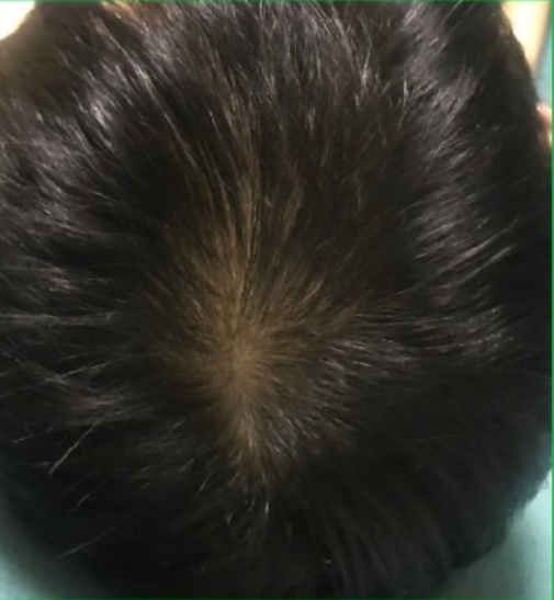 내돈내산 테라픽 프리미엄 토탈 헤어토닉 솔직후기