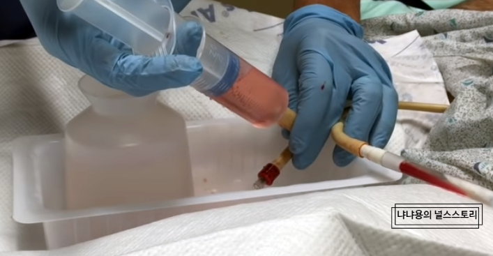 foley, bladder irrigation(B.I)(방광세척) 방법과 목적. 간호기록방법