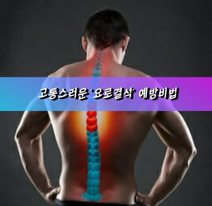 고통스러운 ‘요로결석’ 예방비법 고통스러운 ‘요로결석’ 예방비법