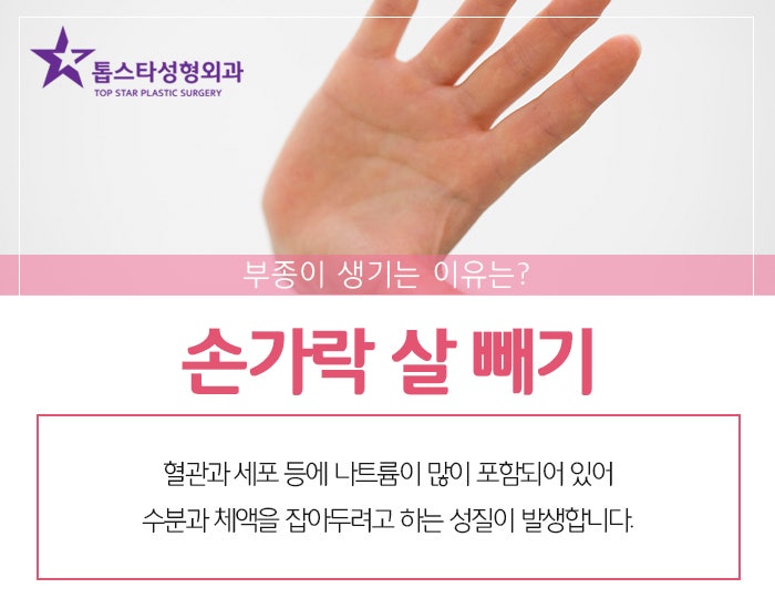 손가락 살 빼기, 운동법을 알아봅시다 : 네이버 블로그