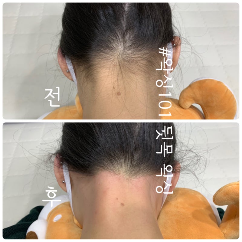 [대전 여성 목선 왁스] 대전유성여성 목선왁스/대전봉명동여성 목선왁스