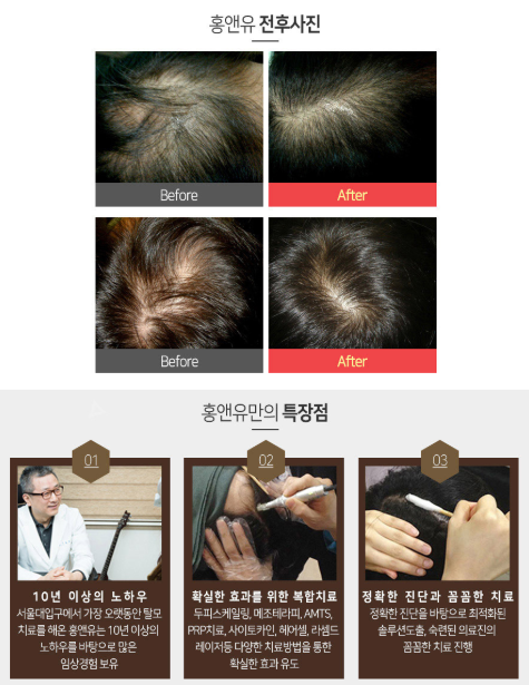 꼼꼼한 관악구낙성대탈모관리