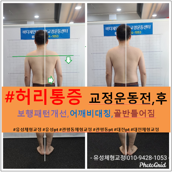 대전체형교정,오십견전문 대전의 몸이 편한 손