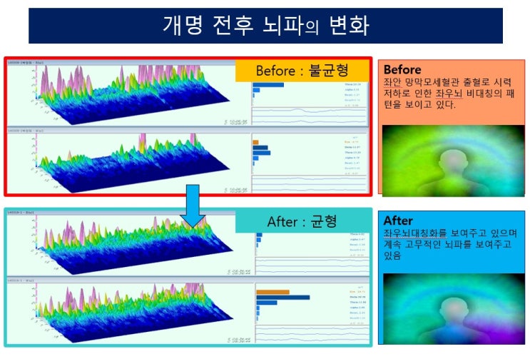 이름은 뇌에 어떻게 영향 미치나?