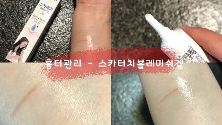  흉터연고 관리하기 쉬운 스카터치블레미쉬겔