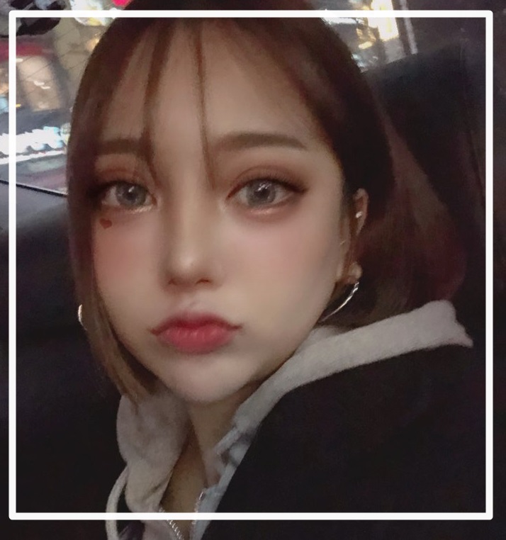  쌍꺼풀수술 이외 중요한 것은?