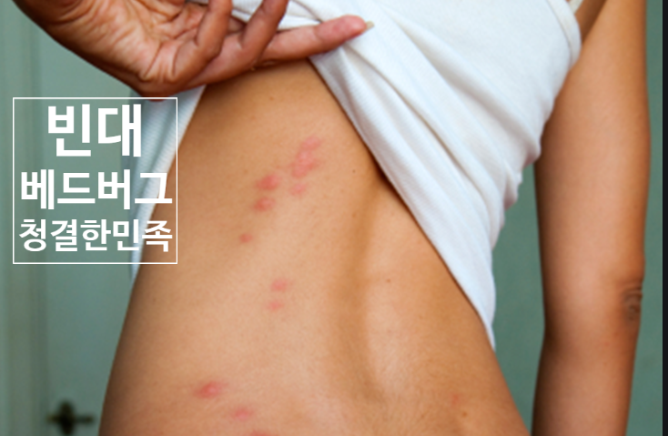 빈대(침대 벌레, 베드 버그, bed bugs) 예방과 완전 퇴치법