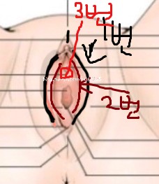  <널스스토리> nelaton(단순도뇨) 하는 이유, 방법, 간호, PVR Check(잔뇨량검사)