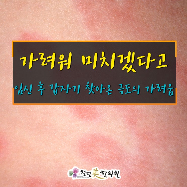 임신중 피부가 심하게 가려운 임신소양증은 대구 청담미한의원이 잘봅니다! 임신중 피부가 심하게 가려운 임신소양증은 대구 청담미한의원이 잘봅니다!