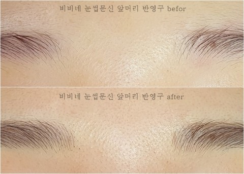  눈썹앞머리 자연스럽게 살리기 미간좁히기는 비비네에서~!/왕십리눈썹문신샵비비네