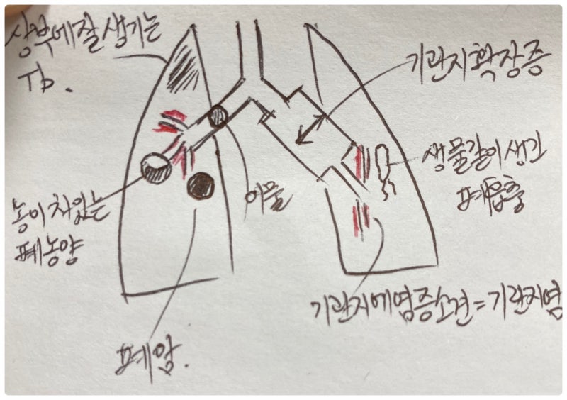 CPX. 순환기/호흡기 감별 질환 요약본 : 네이버 블로그