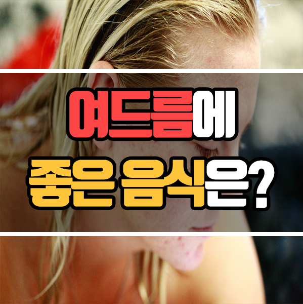  피부 관리 팁 - 여드름에 좋은 음식은 뭐가 있을까?