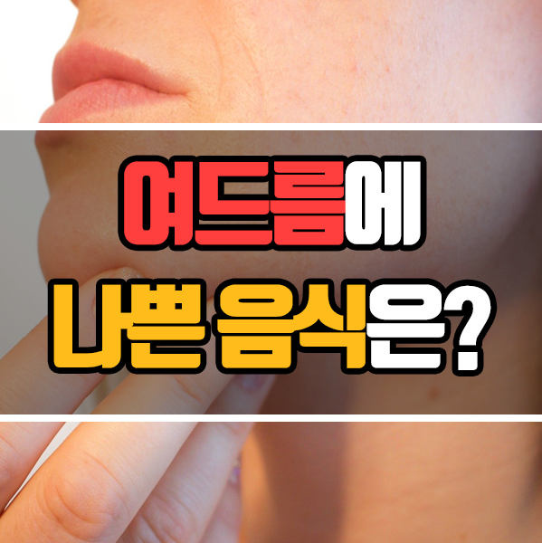  피부 관리 팁 - 여드름에 나쁜 음식은?