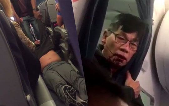 미국에서 인종차별을 가장 심하게 받으면서도 인종차별을 아예 당하지 않는다는 아시아인들 미국에서 인종차별을 가장 심하게 받으면서도 인종차별을 아예 당하지 않는다는 아시아인들