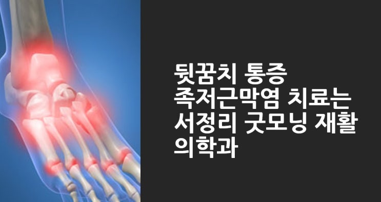  서정리 뒷꿈치 통증은 굿모닝 재활의학과(족저근막염)