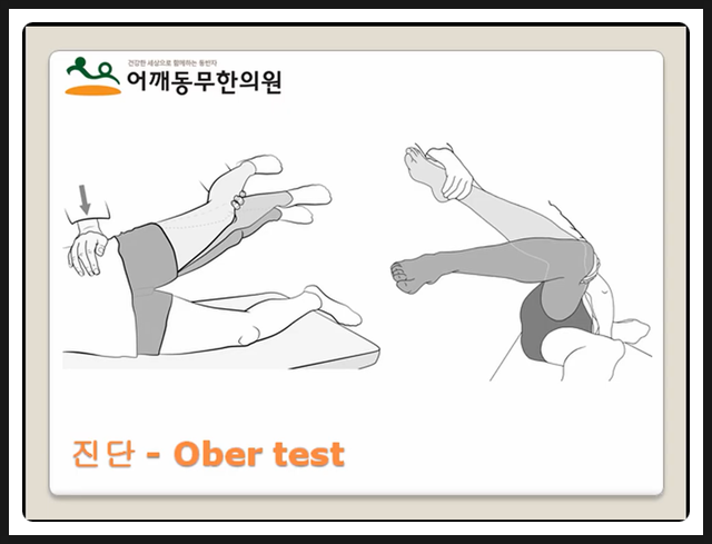 발음성 고관절 (고관절에서 뚝소리가 나요. 고관절소리의 원인과 치료) : 네이버 블로그 발음성 고관절 (고관절에서 뚝소리가 나요. 고관절소리의 원인과 치료) : 네이버 블로그