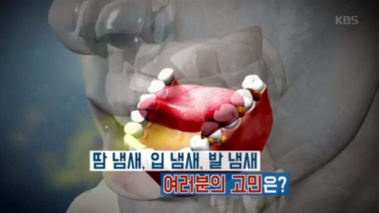  덥고 땀 차는 여름, 몸냄새 없애는 법 - 무엇이든 물어보세요