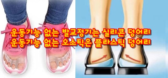 기능성신발 깔창과 발가락교정기 효과있나요?