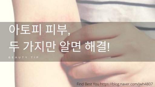 아토피 낫는 법, 두 가지만 알면 해결!